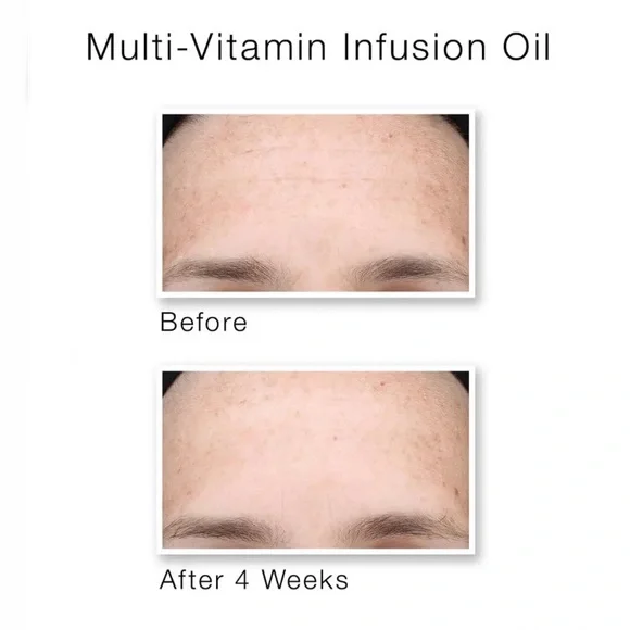 Murad Multi-Vitamin Infusion Oil